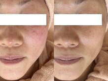 ミュー 春日井店(mieux)