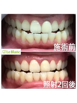 ルブラン 奈良店(Le Blanc)/7日間で変われます！