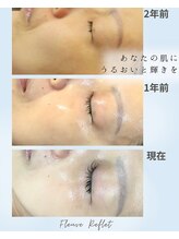 フルーヴ ルフレ(Fleuve Reflet)/☆継続エステの効果☆