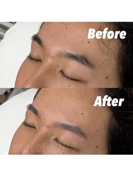 モテテ 池袋店(motete)/お客様施術例☆池袋 7