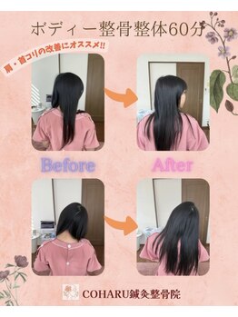 コハル鍼灸整骨院 本郷三丁目(COHARU鍼灸整骨院)/ボディー整体☆首の可動域改善