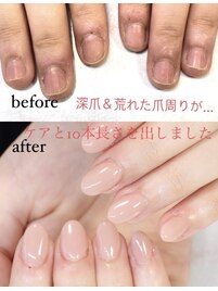 【スカルプ長さだし】ワンカラー