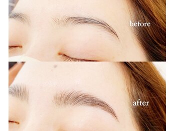 サティシア(SATIXIA)/ハリウッドブロウリフト