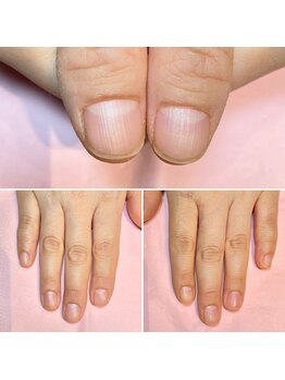 ココデネイル(cocode nail)/悩み:爪が薄い(40代前半)