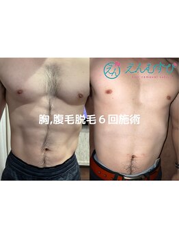 エンムスビ(enmusubi)/