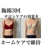 サロンツキ(salon tuki)/バストケア症例