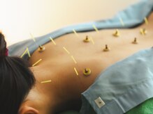 ボディーキュア アオイ(Body cure Aoi)/繰り返すつらい肩こりに