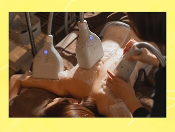 ブルースター 上小田井店(Blue Star)/5.冷却カップをつけます