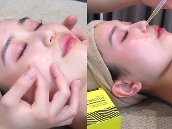 ティー(T)の写真/【レモンボトル】超希少「LEMON BOTTLE」話題の先進美容導入☆心踊るような「非日常体験空間」を是非。