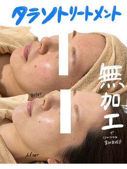 ラカ 長野駅前本店(LaKa)/無加工でここまで綺麗