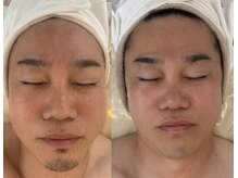 ミピマム 恵比寿店(Mipimam)/いつまでも若々しく！