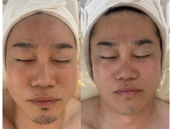 ミピマム 恵比寿店(Mipimam)/いつまでも若々しく！