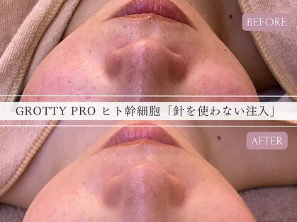 ワイビューティ(Y.Beauty)の写真