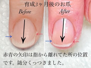 トゥインクリーネイルサロン(Twinkly Nail Salon)/【最強のネイルケア】1回お試し