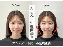 アライメントトウキョウ 表参道(Alignment TOKYO)