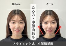 アライメントトウキョウ 表参道(Alignment TOKYO)