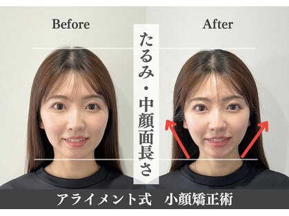 アライメントトウキョウ 表参道(Alignment TOKYO)の写真