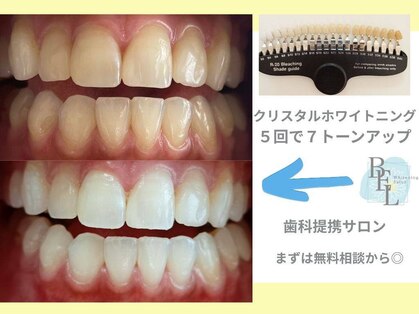 ベル(BEL)の写真