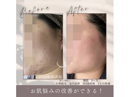 モアトゥインクル 福山宮通り店(MORE twinkle)の写真