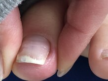 トゥーネイル(02nail)/