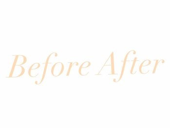 ストーリー(STORY)/ハーブピーリング専門店STORY