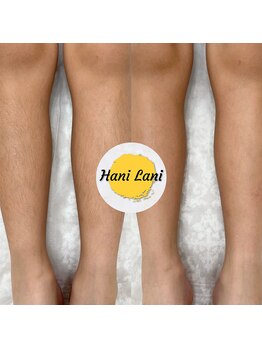 ハニ ラニ(Hani Lani)/“キッズ”シュガーリング