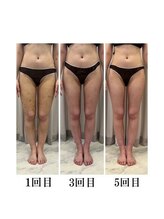 インディバケアプラチナム 横浜店/インディバ施術