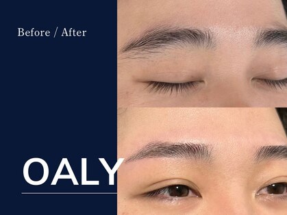 オアリー(OALY)の写真