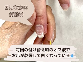 ビーエスネイル 金山店(bs-nail)/傷んでしまったお爪へ美容液