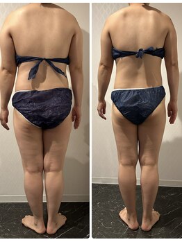 ビューティーサロン ラグジューム(Beauty salon Laxum)/エンダモロジーとダイエット！