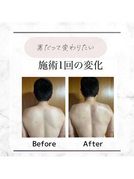 クラッシー(Classy)/男性の施術も可能です