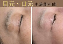 ビィーチェ(VIECE)