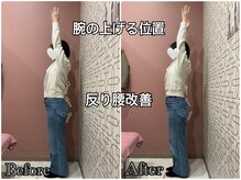 ユルル 刈谷店(Yururu)/before・after（骨盤整体）