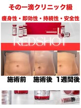サロン シャンティー/レッドショット脂肪燃焼