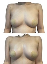 痩せラボ/ふっくらしたお胸へ