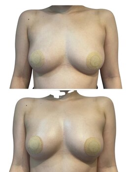 痩せラボ/ふっくらしたお胸へ