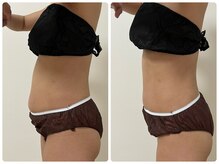 巡りサロン結希(ゆき)/腸マッサージ