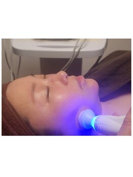 美白ケアをしたい