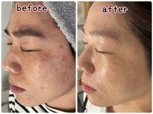 ケースタイル(k.style)/フェイシャルWAX3回目