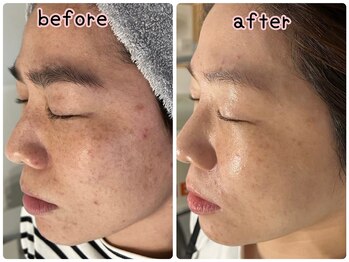 ケースタイル(k.style)/フェイシャルWAX3回目