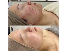 アルゴ 小倉守恒店(ALGO)の雰囲気（脱毛×フェイシャルで本気の肌質改善！）