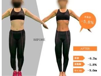 ジーサルース(Gサルース)/A様（３０代）【２カ月】　前