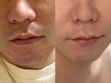 クラウン 心斎橋店(CROWN)/