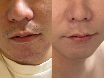 クラウン 心斎橋店(CROWN)/