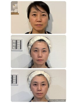 ミヨン(Miyong)/エニシーグローパック