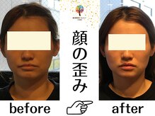 クレスト(CREST)の雰囲気（BeforeAfter！小顔矯正×小顔コルギで顔の歪み.左右差が激変！！）