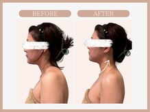 アコガレコガオ 山形店/