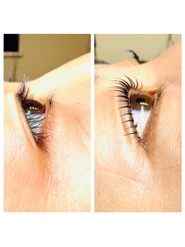 サロンララ(Salon Lala)/Before/After L3リフト