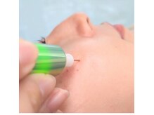 リトラリス(Littoralis)