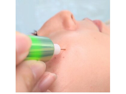 リトラリス(Littoralis)の写真